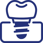 Implantes dentários